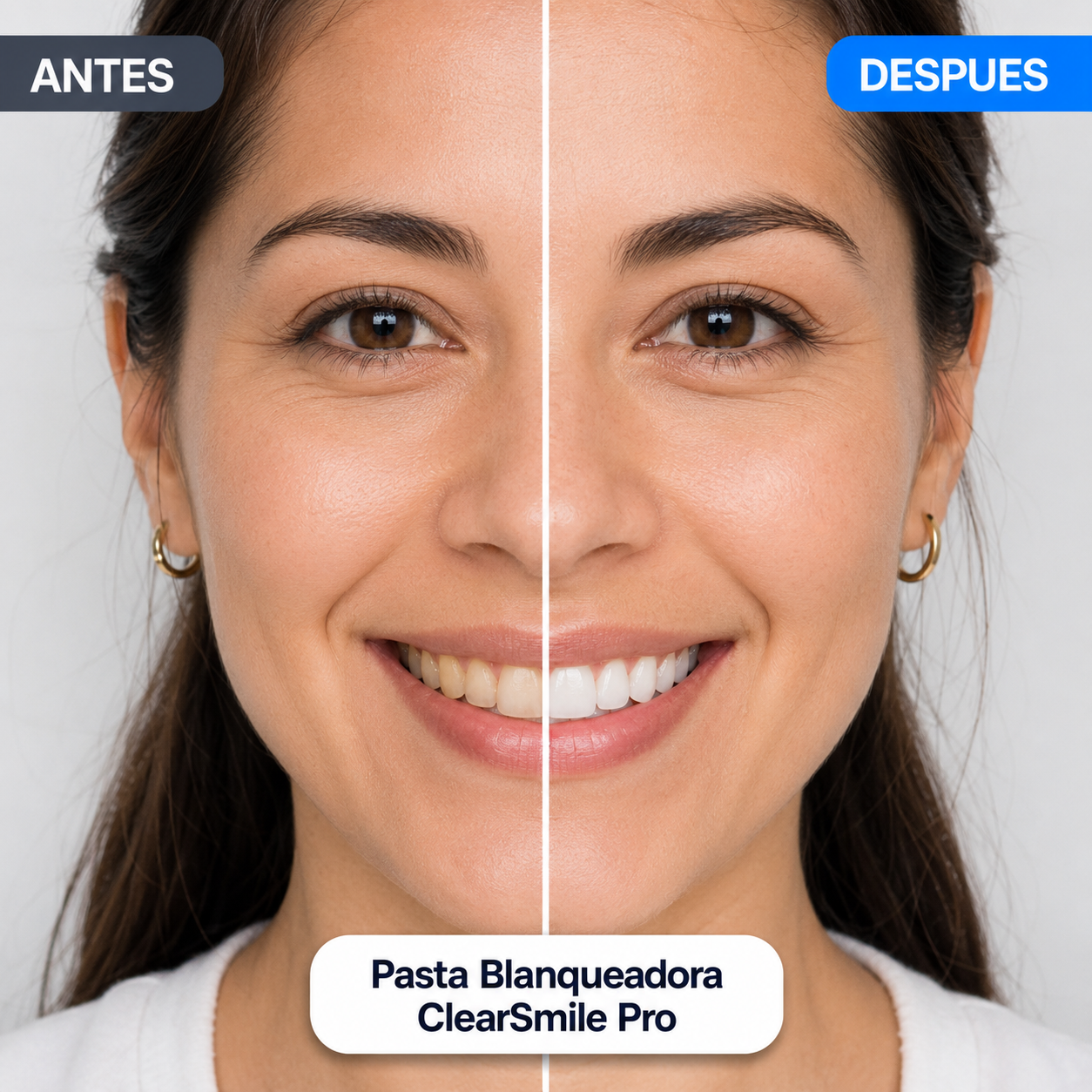Carillas Instantánea Snap-on Smile