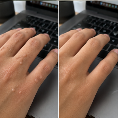 LumiClear Pro® — 3 problemas de piel. Un solo dispositivo.